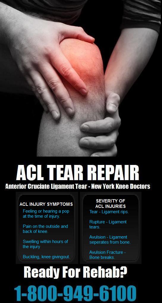 ACL Injury Doctor