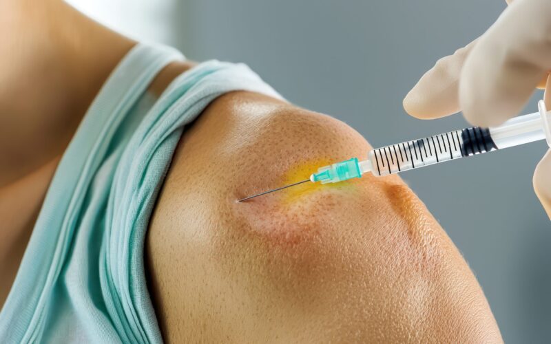 Visual guide to shoulder joint injections for pain management, emphasizing tendon and muscle strain. Picture of shoulder botox injection techniques for pain management, highlighting tendon and muscle strain areas.