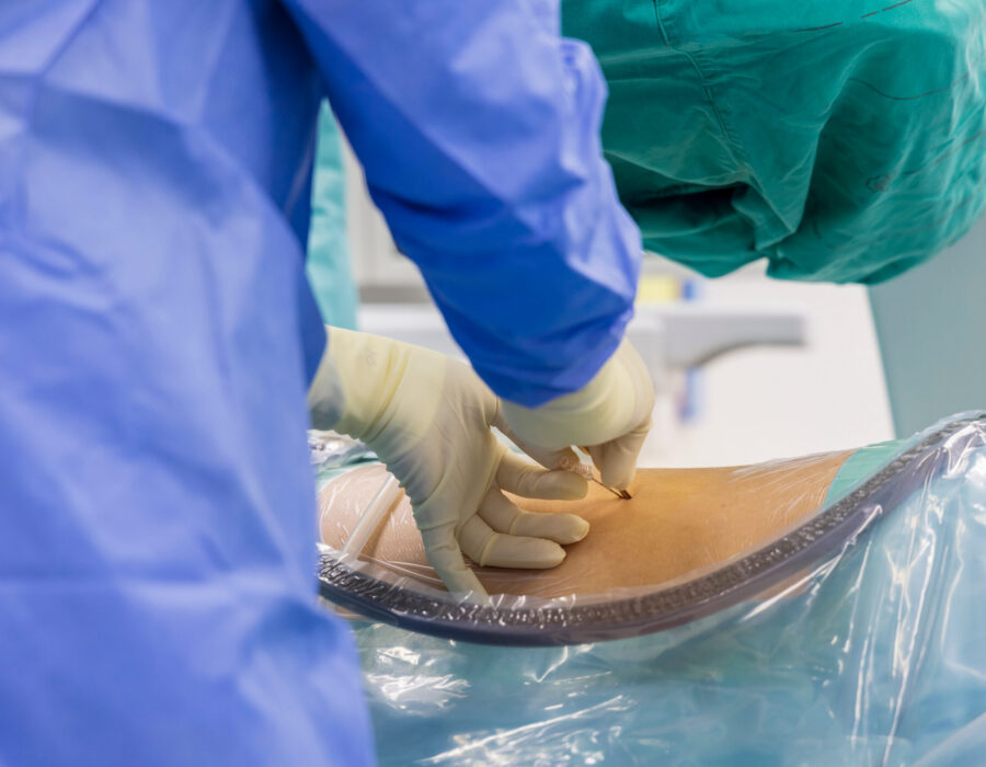 Medical provider performing an epidural steroid injection procedure for back and nerve pain management.