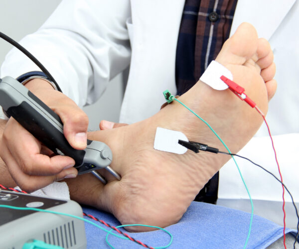 Somatosensory Evoked Potentials (SEP) or Nerve Conduction Velocity (NCV) is a test of electrical signals through a nerve, done in conjunction with an electromyography (EMG) to check the muscles Healthcare provider performing EMG and nerve conduction testing on a patient's foot and lower leg to evaluate nerve function